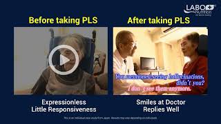 NeuroREGAIN See the difference before and after taking Neuroregain scallopderived plasmalogens [upl. by Ttennej]