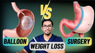 Difference Between Weightloss Balloon amp Weightloss Surgery Explained weightlosstreatment [upl. by Ytirahc]