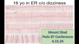 Mount Sinai Pediatric EP Conference 41524 [upl. by Ymia877]