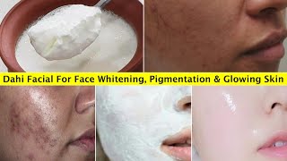 1 Time Skin Whitening Dahi Facial👆that removes Pigmentation amp Dark Spots Brightens Dull Dark Skin [upl. by Arehahs]