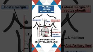 Ventral Hernia Classification surgicaleducation neetpg conceptualsurgery [upl. by Avra]