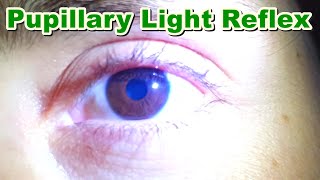 Pupillary Light Reflex  Contraction of Pupil MiosisMyosis  Function  Brain Stem [upl. by Orban]