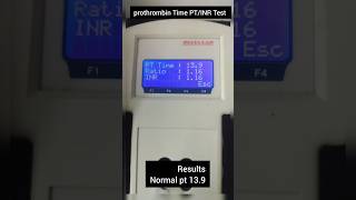 Prothrombhi time test of procedure  Pt INR test shorts short view video [upl. by Ahsercal942]