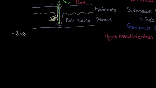 Acne Vulgaris Part 2 [upl. by Reffotsirhc281]