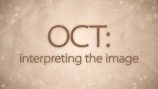 OCT Interpreting the image [upl. by Nido]