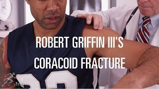 RGIII suffers a coracoid fracture  Thats Gotta Hurt with Dr David Geier [upl. by Alyson]