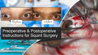 Preoperative amp Postoperative Instructions for Squint Surgery  Squint Surgery  Vision Eye Centre [upl. by Akkinahs951]