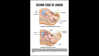 Second Stage Of Labour  Normal Labour  Midwifery amp Gynaecological Nursing [upl. by Oicelem]