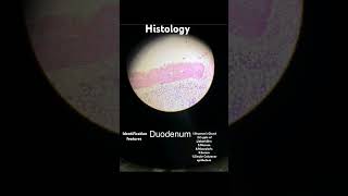 ANATOMY  HISTOLOGY  DUODENUM  IDENTIFICATION FEATURES mbbs anatomy medstudent life doctor [upl. by Oleusnoc]