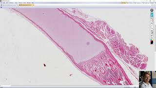 endochondral ossification [upl. by Elokyn]