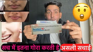 असली सचाई  Dermikem oc cream  dermikem oc cream review  dermikem oc cream ke fayde  Dermikem [upl. by Leal513]