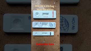 HIV HCV HbSag test  HIVHbSagHCV test kaise kare  pathology medical shorts [upl. by Surat510]