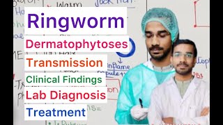 Ringworm  Dermatophytoses  Properties  Clinical  Transmission  Treatment [upl. by Ennoid811]