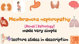 Membranous nephropathy  Renal  Pathology  Med Vids made simple [upl. by Notsnhoj]