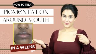 How To Treat PIGMENTATION Around Mouth  Chetali Chadha [upl. by Enileve]