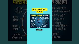 Symptoms of multiple myeloma shortsfeed multiplemyeloma drstethombbsmdmedicine health trending [upl. by Naul]