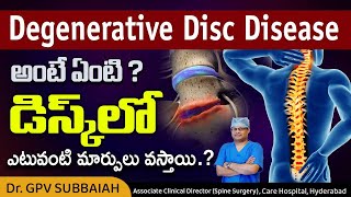 What is degenerative disc disease DDD   What happens in the disc in DDD  Dr GPV Subbaiah [upl. by Castor]