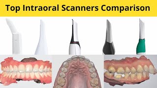 Top Intraoral Scanners Comparison [upl. by Biebel]