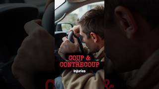 Coup and Contrecoup Head Injury shorts youtubeshorts [upl. by Bick8]