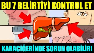 BU 7 BELİRTİ KARACİĞERİNİZDE SORUN OLDUĞUNU GÖSTERİR İHMAL ETMEYİN şifabul karaciğer [upl. by Lemrej]