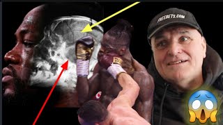 BREAKING NEWS❗ OH OHHH DEONTAY WILDERS SKULL IS CRACKED BECAUSE OF TYSON FURY ❗🚨 [upl. by Freeman306]