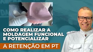 Como realizar a MOLDAGEM FUNCIONAL e potencializar a RETENÇÃO em PT [upl. by Sitruk]