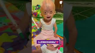 SONO DUE BAMBINE MERAVIGLIOSE EliseEloa purasatisfacao PROGERIA [upl. by Domingo]