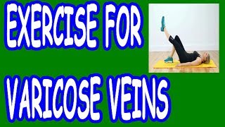 Exercise For Varicose Veins  How to Do It  Easy Varicose Revival [upl. by Yllaw409]