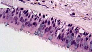 Pseudostratified Columnar P1 [upl. by Oribelle]