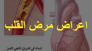 اعراض مرض القلب [upl. by Nork]