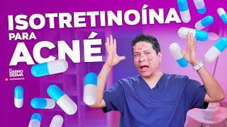 ISOTRETINOÍNA PARA ACNÉ  DERMATÓLOGO OPINA [upl. by Norita206]