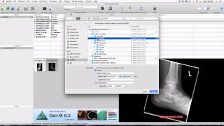 How to import DICOM and JPEGs into OsiriX Lite [upl. by Graybill859]