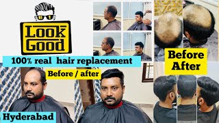 100  natural looking hair patch  Nonsurgical hair replacement Hyderabad  Look good hair studio [upl. by Oisinoid955]