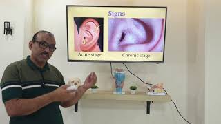 Eczematous otitis externa Malayalam Patient teaching programme [upl. by Abeh]