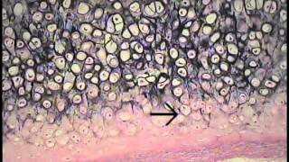 Cartilage and Bone Histology FreeMedEd [upl. by Dionne328]