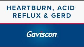 Heartburn Acid Reflux and GERD  Gaviscon® [upl. by Otreblanauj]