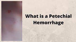 What is a Petechial Hemorrhage [upl. by Morez429]