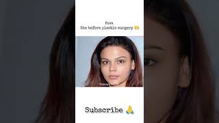 She before plastic surgery x she after plastic surgery treadingshorts bollywood [upl. by Einaj734]