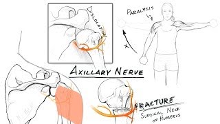 The Brachial Plexus II Animated Review HD [upl. by Pomcroy525]