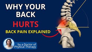 Back Pain from Spondy Sciatica Stenosis  Causes amp Pain Fix [upl. by Oemor120]