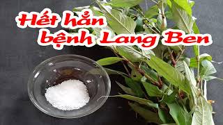 Hết hẳn bệnh lang ben tận gốc chỉ bằng 1 nắm lá rau răm [upl. by Rosette]