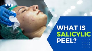 What is Salicylic Acid peel Does it actually work [upl. by Edson493]