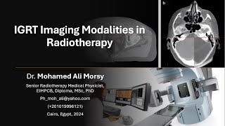 IGRT Imaging Modalities in Radiotherapy [upl. by Arun133]