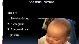 Whats Spasmus nutanshead nodding Torticollisnystagmusoptic gliomaAED vitamin DIron treatment [upl. by Needan]