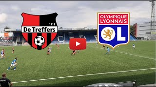 🔴 DE TREFFERS  LYON LIVE HD INTERNATIONAL CLUB FRIENDLY MATCH ONLY SUBSCRIBERS [upl. by Analat771]