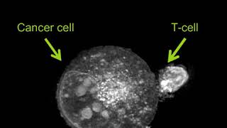 Labelfree Live Cell Imaging Activated TCell Killing Cancer Cell [upl. by Tapes157]