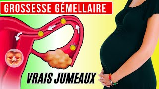 Grossesse gémellaire comment se forment les vrais jumeaux [upl. by Animsay610]