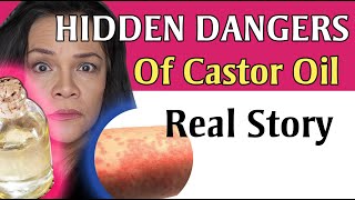 What You Need To Know About Castor Oil TRUE STORY Shared [upl. by Aziza]