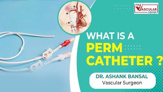 Permanent Catheters क्या होता हे  Purpose Placement and Care  By Dr Ashank Bansal [upl. by Eeliah]