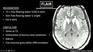 MRI Sequences [upl. by Crowley790]